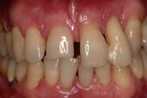 parodontologia1_clip_image002